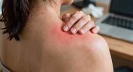 recurring shoulder stiffness issues